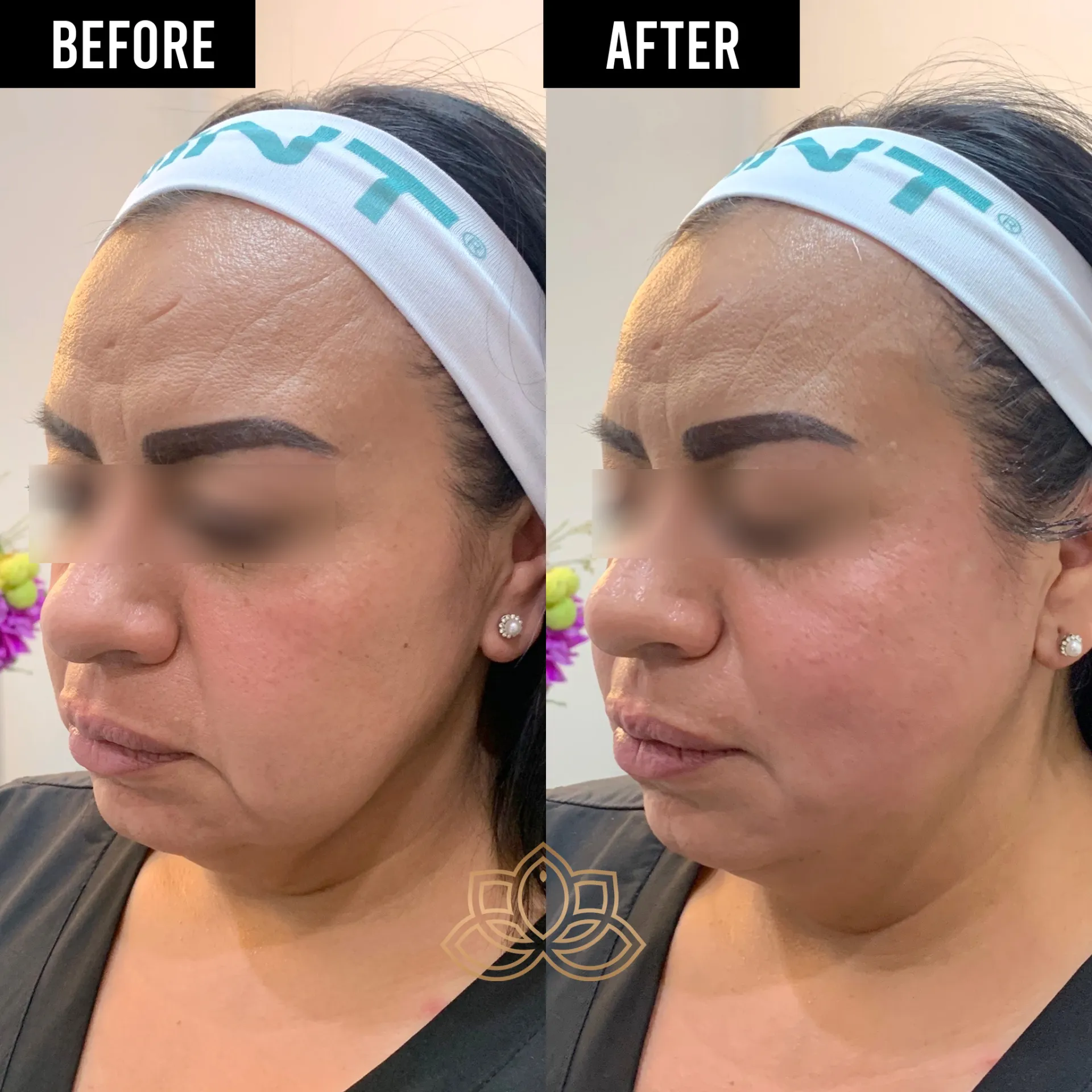 Antes