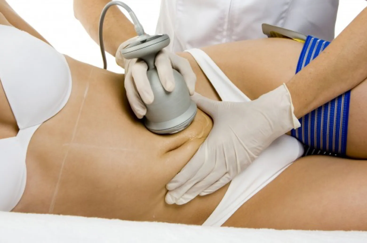 Carboxiterapia