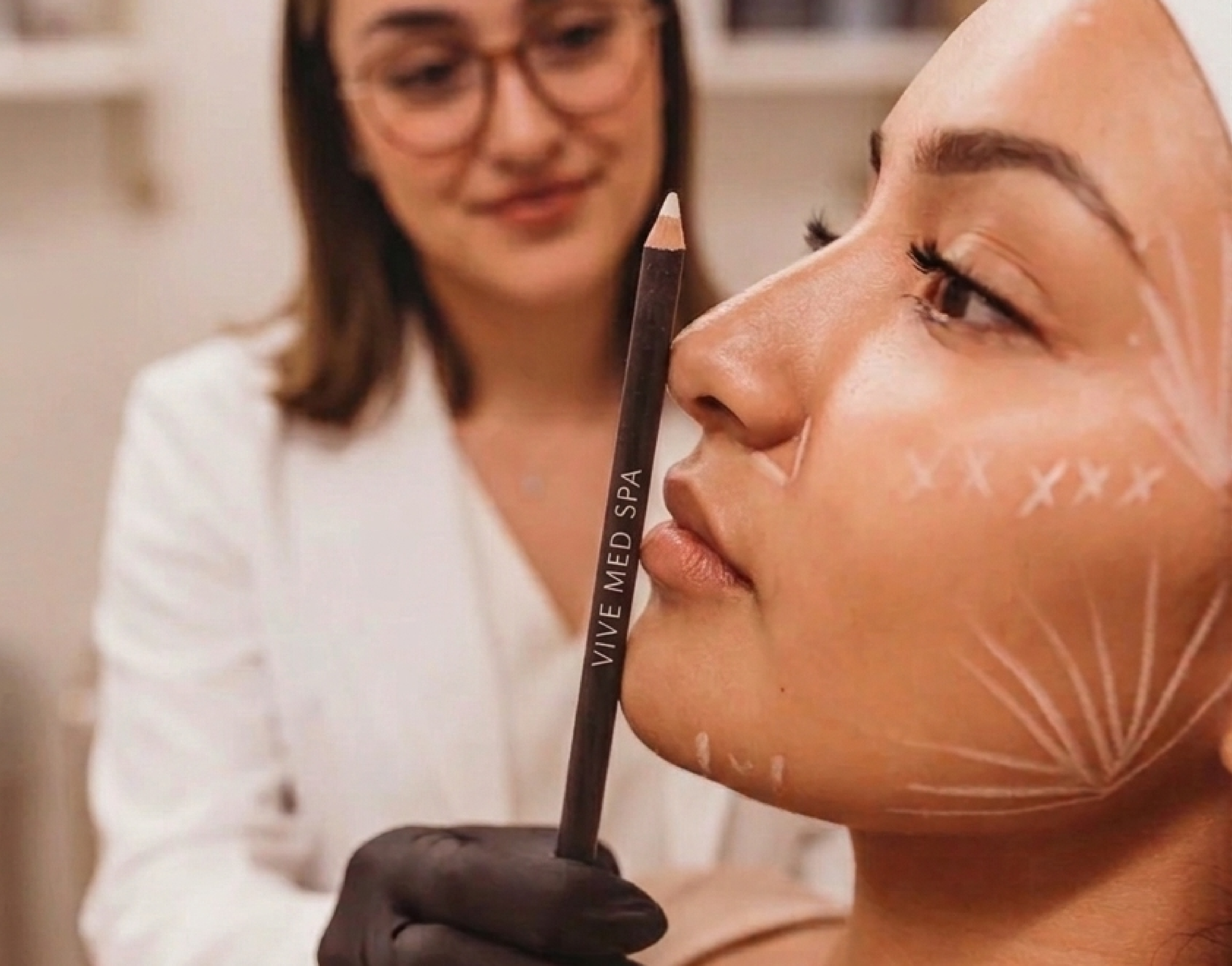 Chin Augmentation at Vive Medical Spa Tijuana